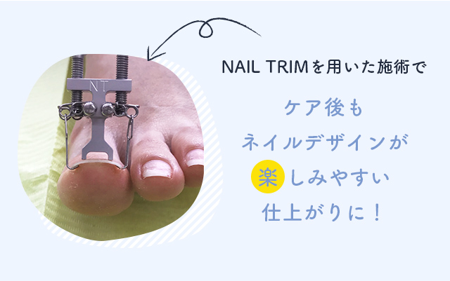 NAIL TRIMを用いた施術でケア後もネイルデザインが楽しみやすい仕上がりに！